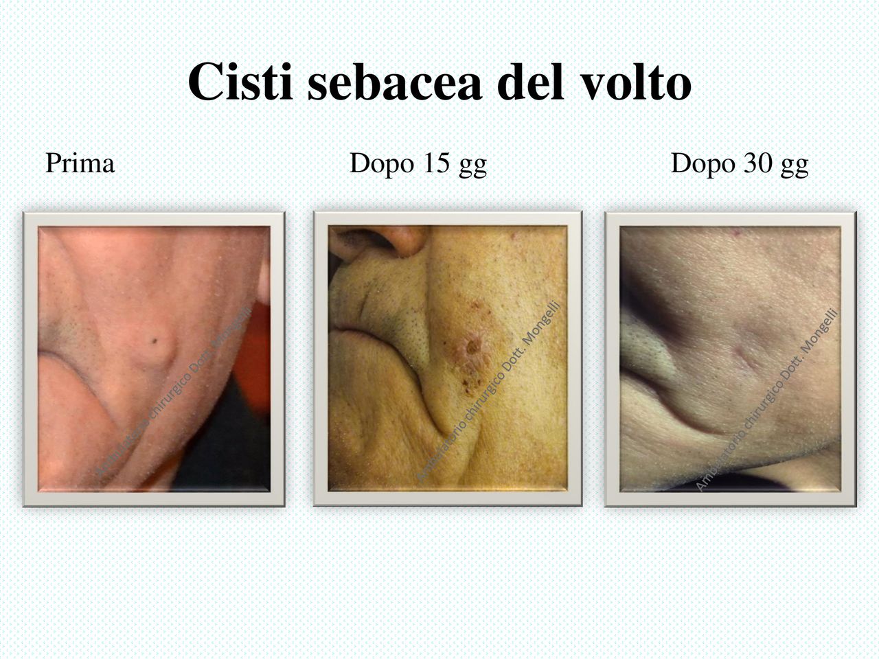 Matteo Antonio Mongelli-7