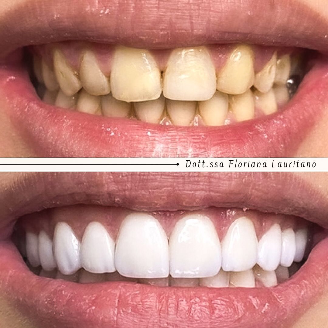 Floriana Lauritano-23