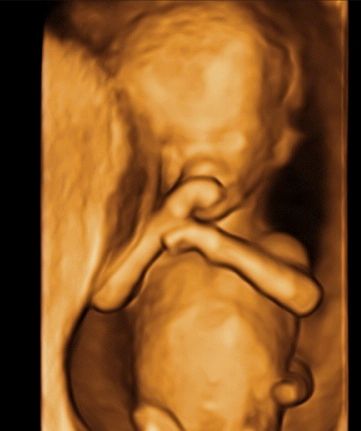 Tommaso Incandela-21