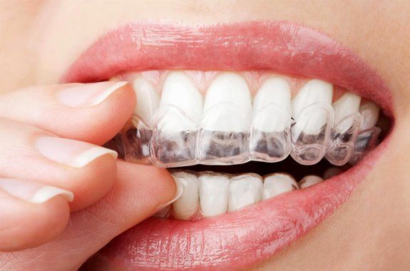 Ernesto Ruiz Chumilla-7