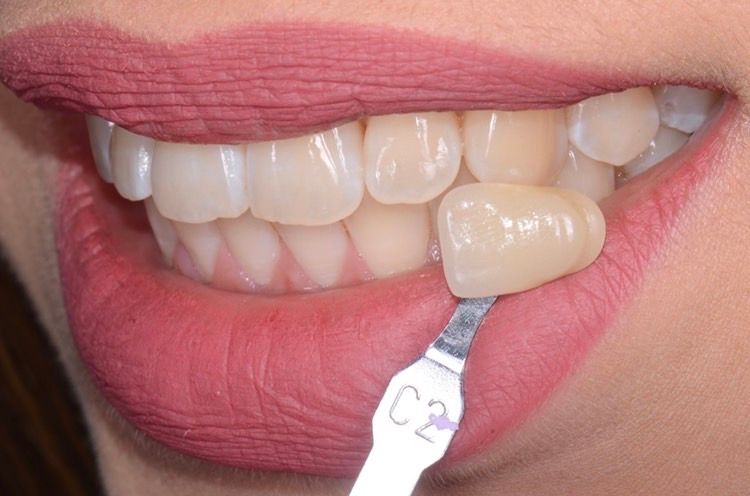 Giovanni Giordano-38