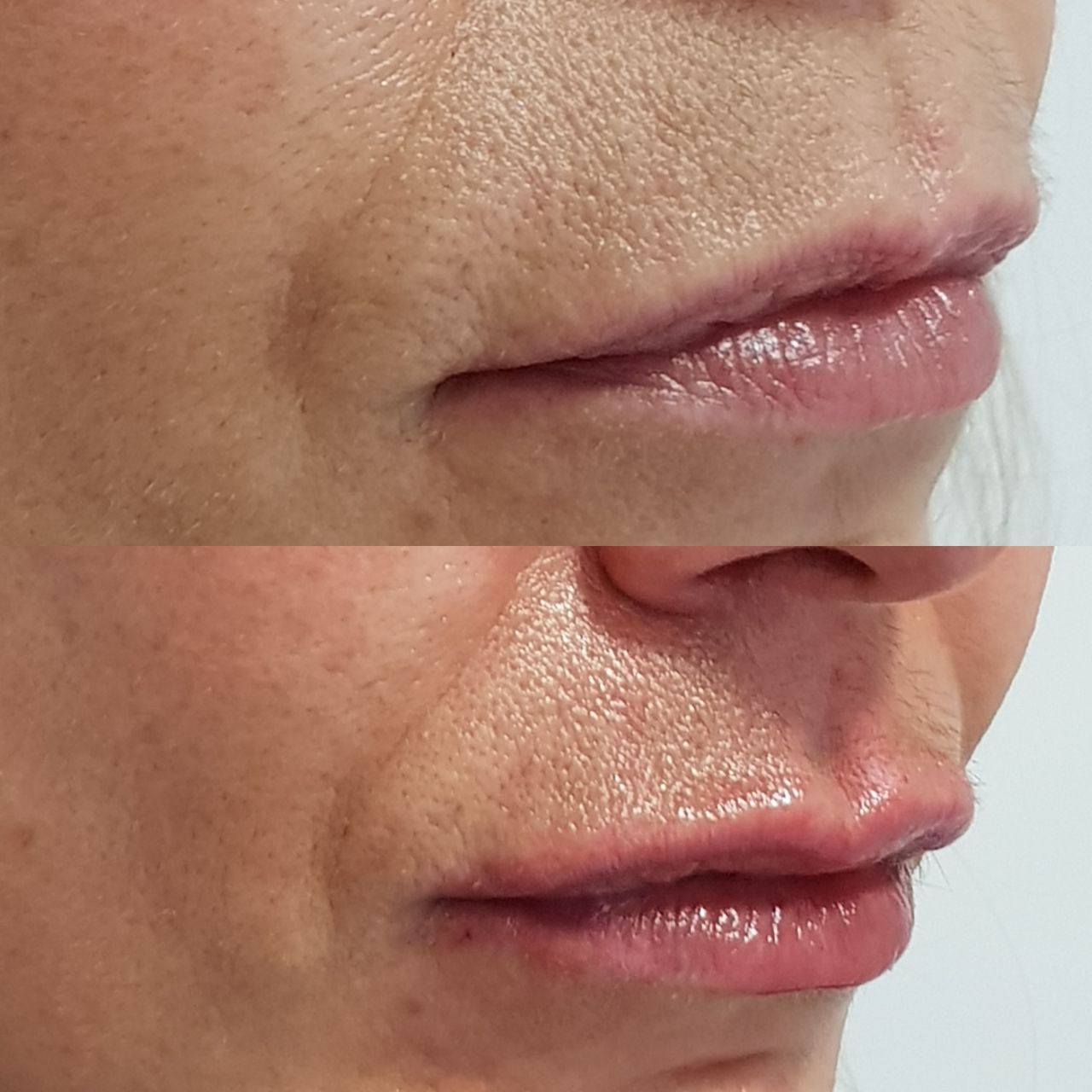 Rosalba Herrero Zerpa-277