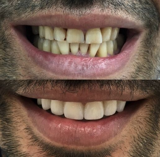 Carlos Carrascosa Milo-3