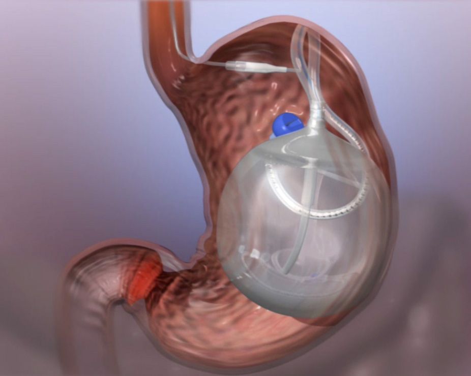 Román Turró Arau-1