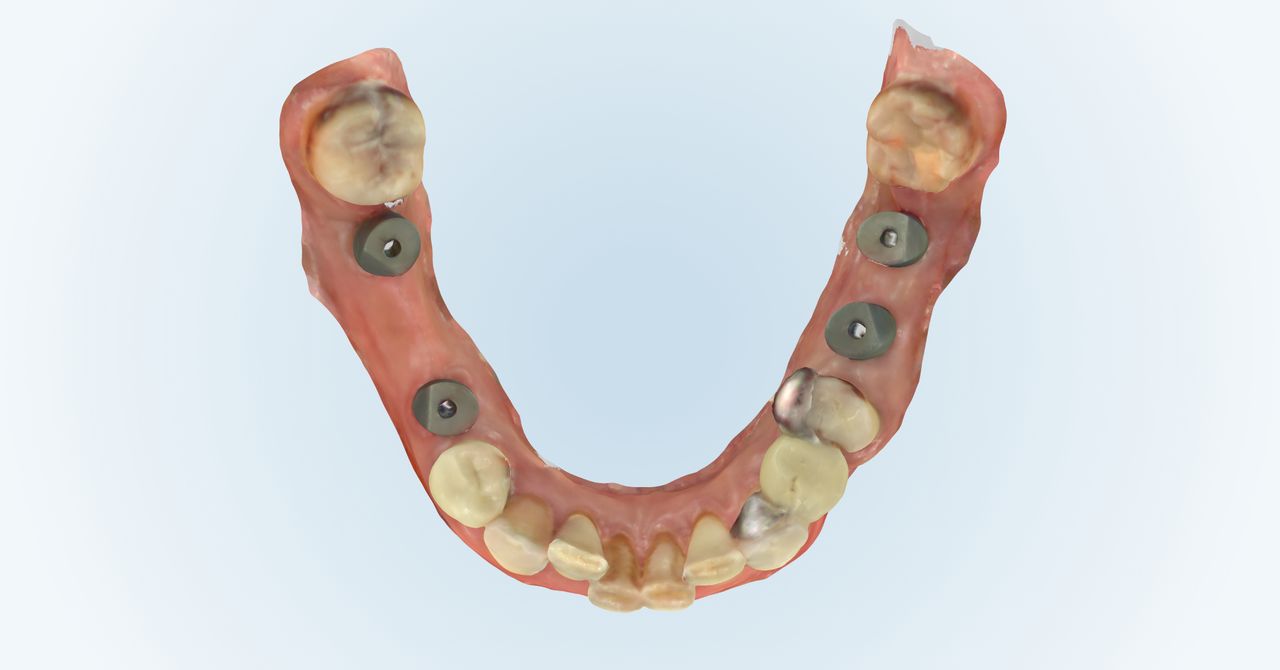 Giulio Bortolussi-11