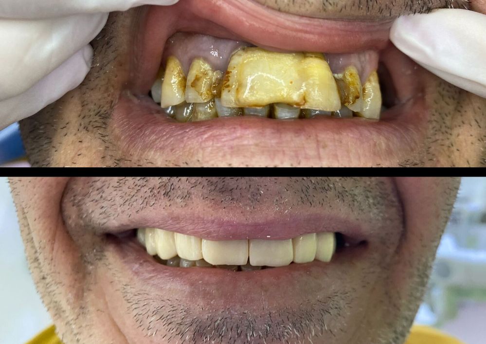 Alessandro Cassese-15