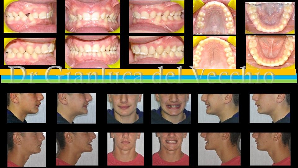 Gianluca Del Vecchio-7