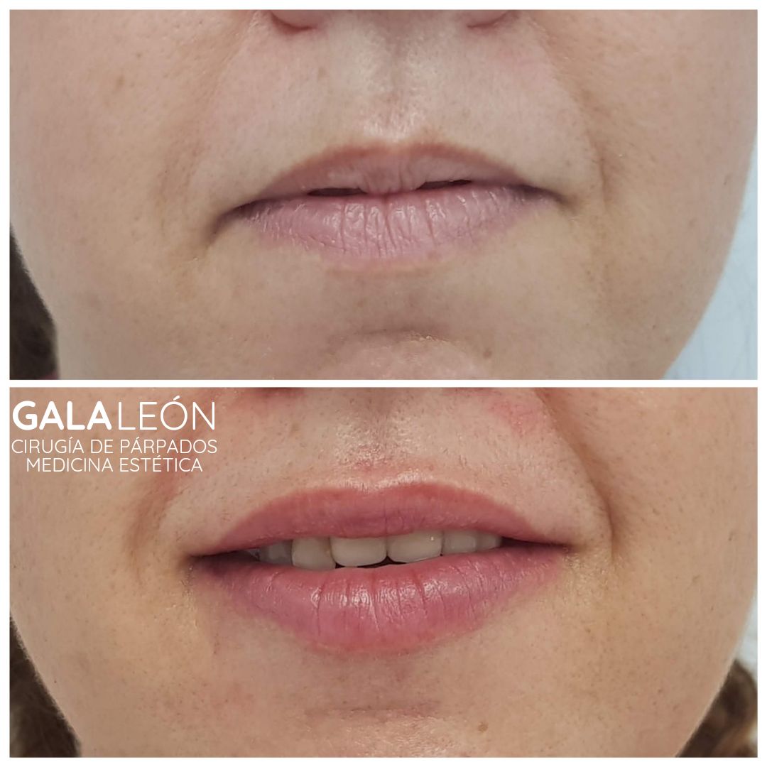 Gala P. Leon Salvatierra-27