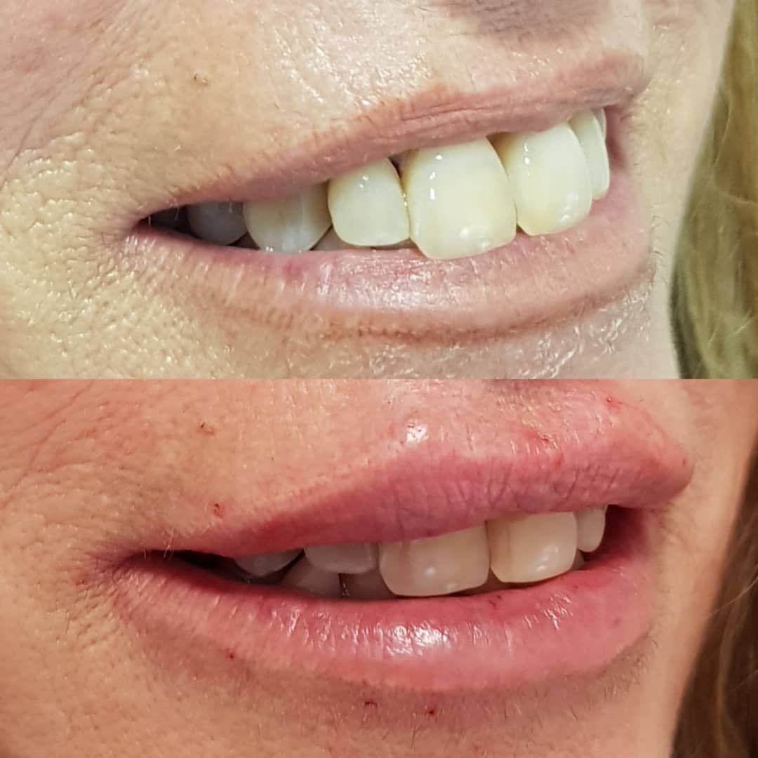 Rosalba Herrero Zerpa-473