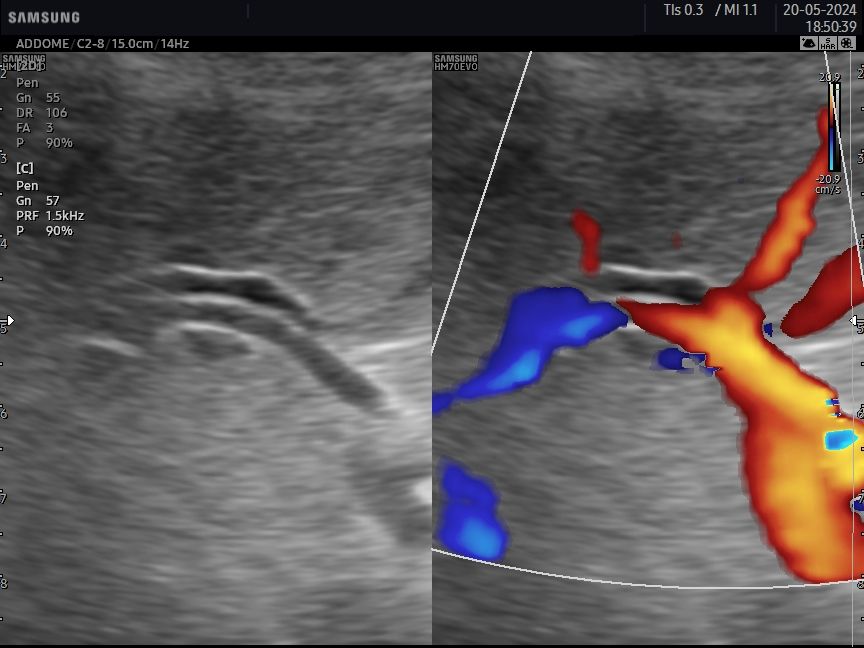 Gianluca Cisternino-18