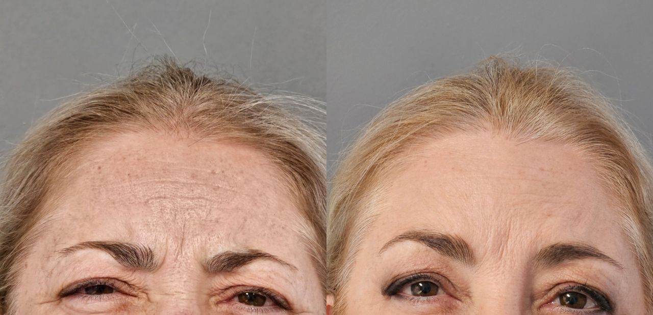 Rosalba Herrero Zerpa-548