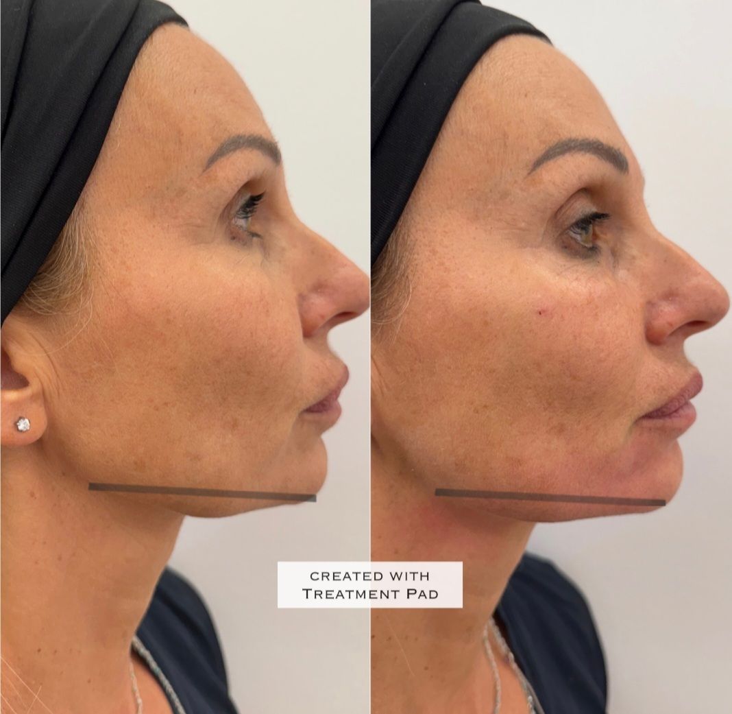 Federica Ingallina-17