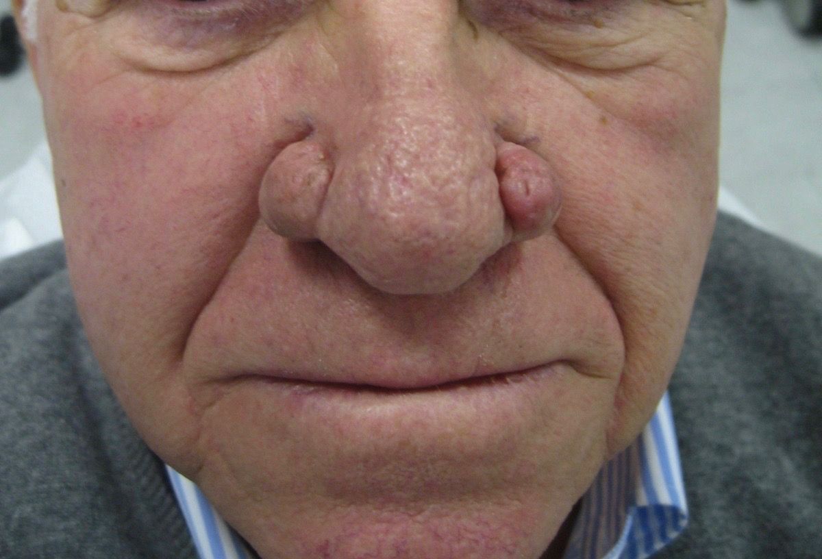 Franco Buttafarro-15