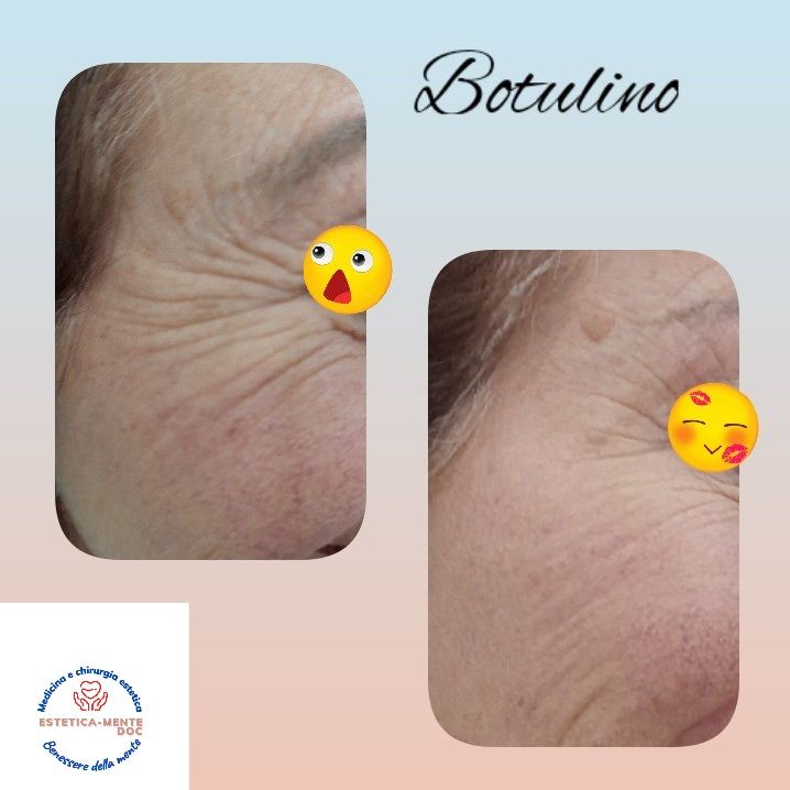 Paola Della Rocca-61