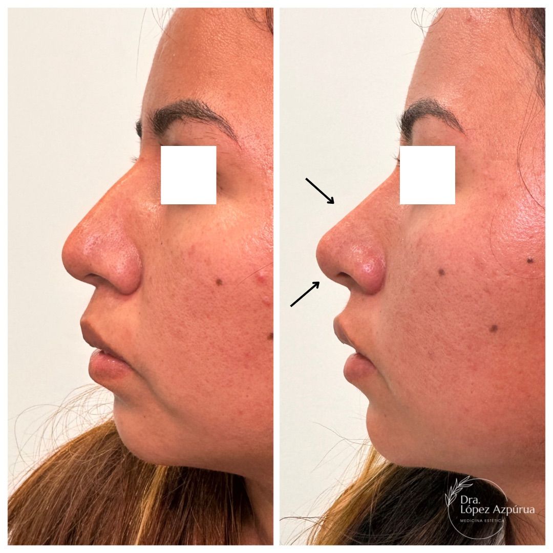 Alexandra López Azpúrua-2