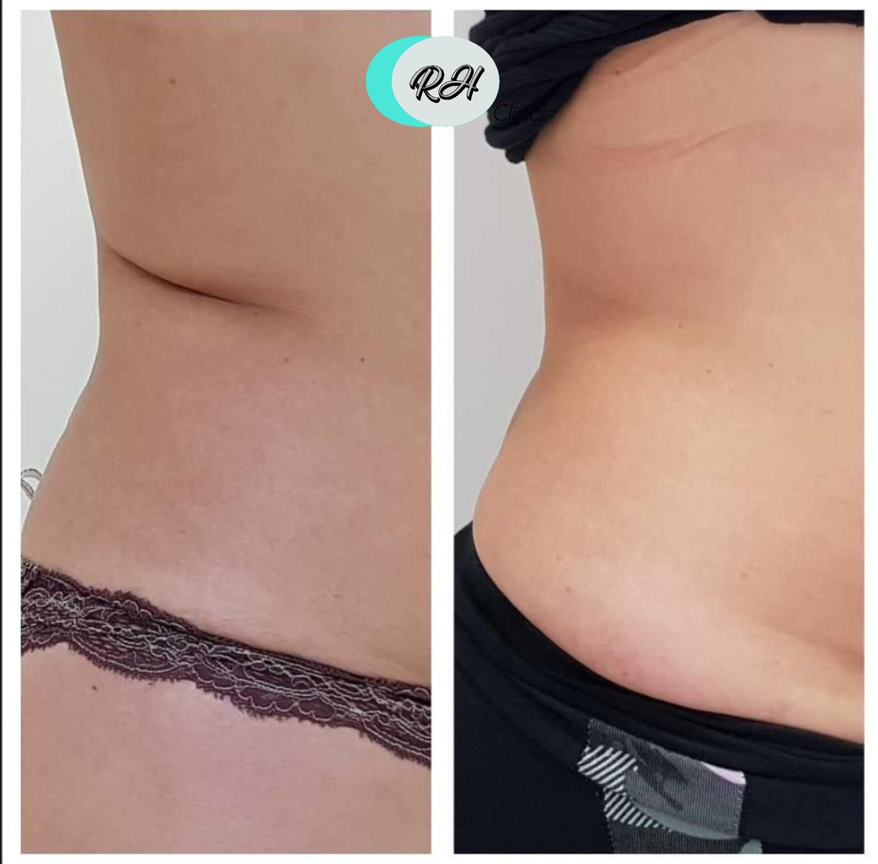 Rosalba Herrero Zerpa-619