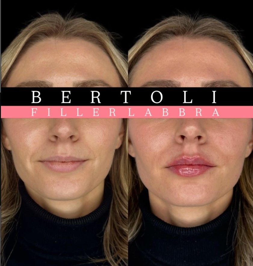 Andrea Bertoli-26
