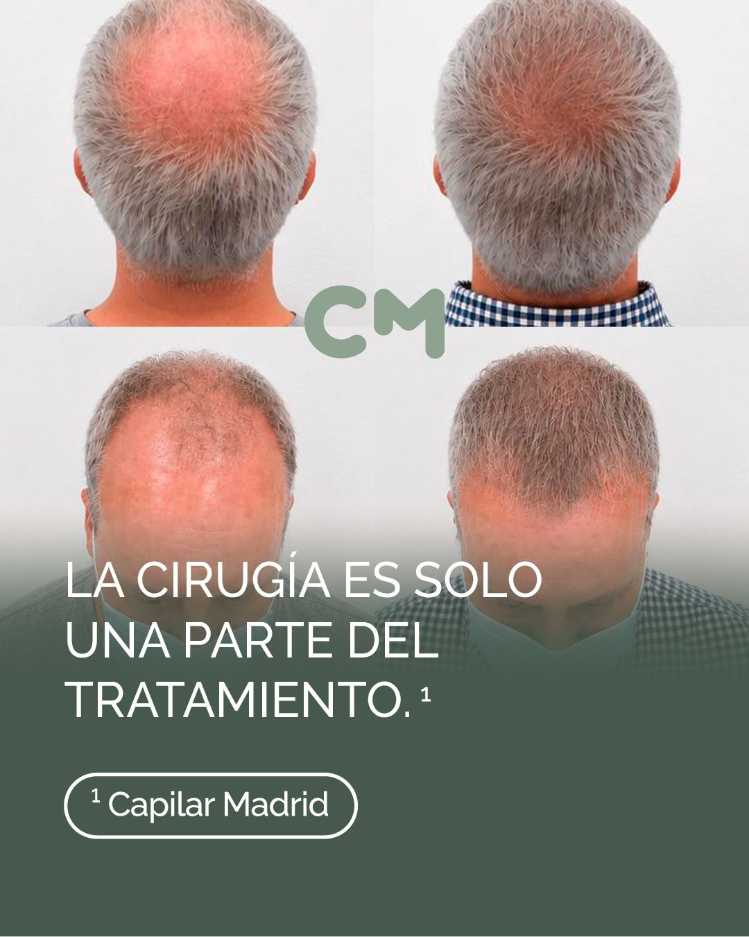 Álvaro Mellado Román-6