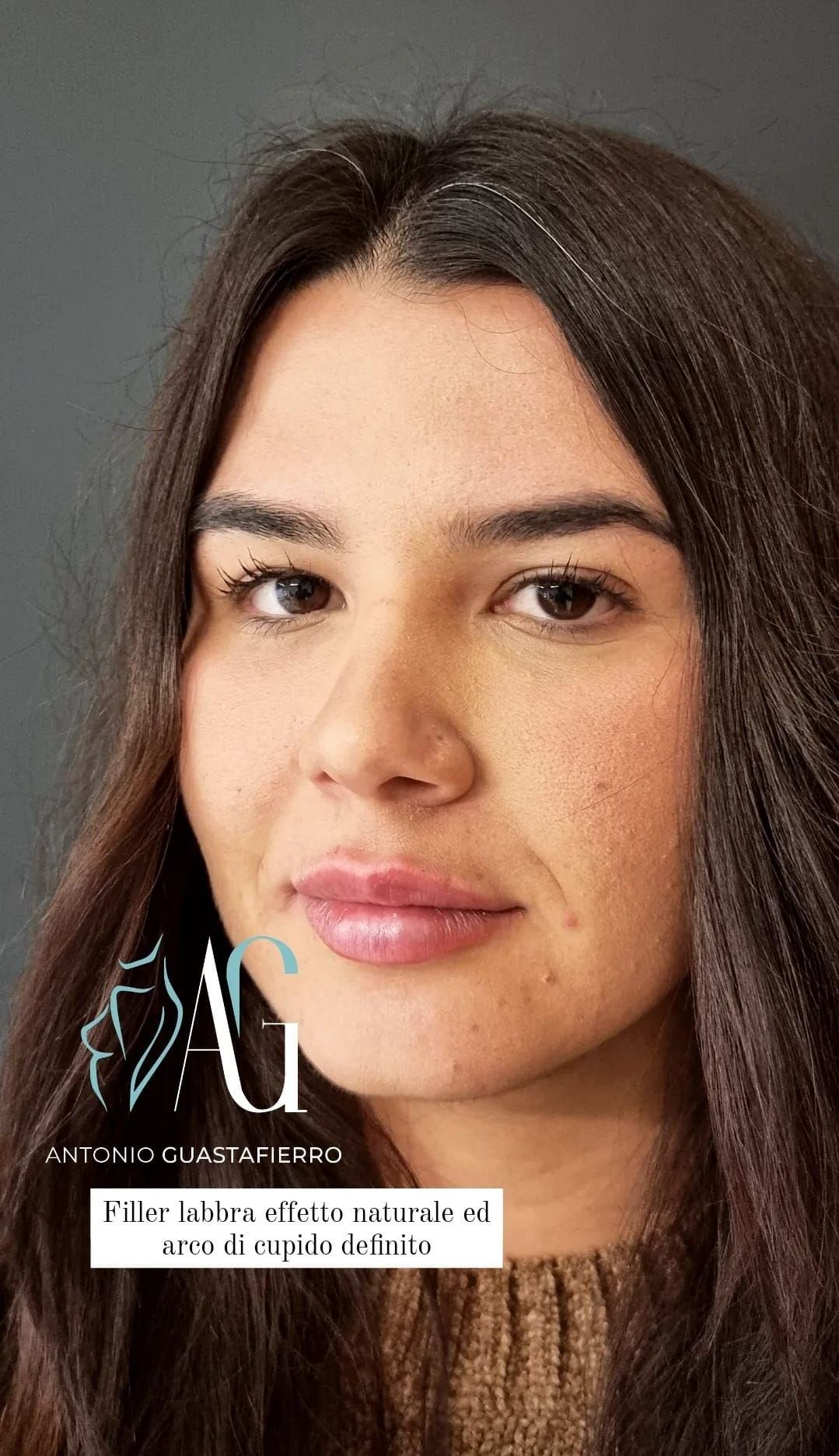 Antonio Guastafierro-14