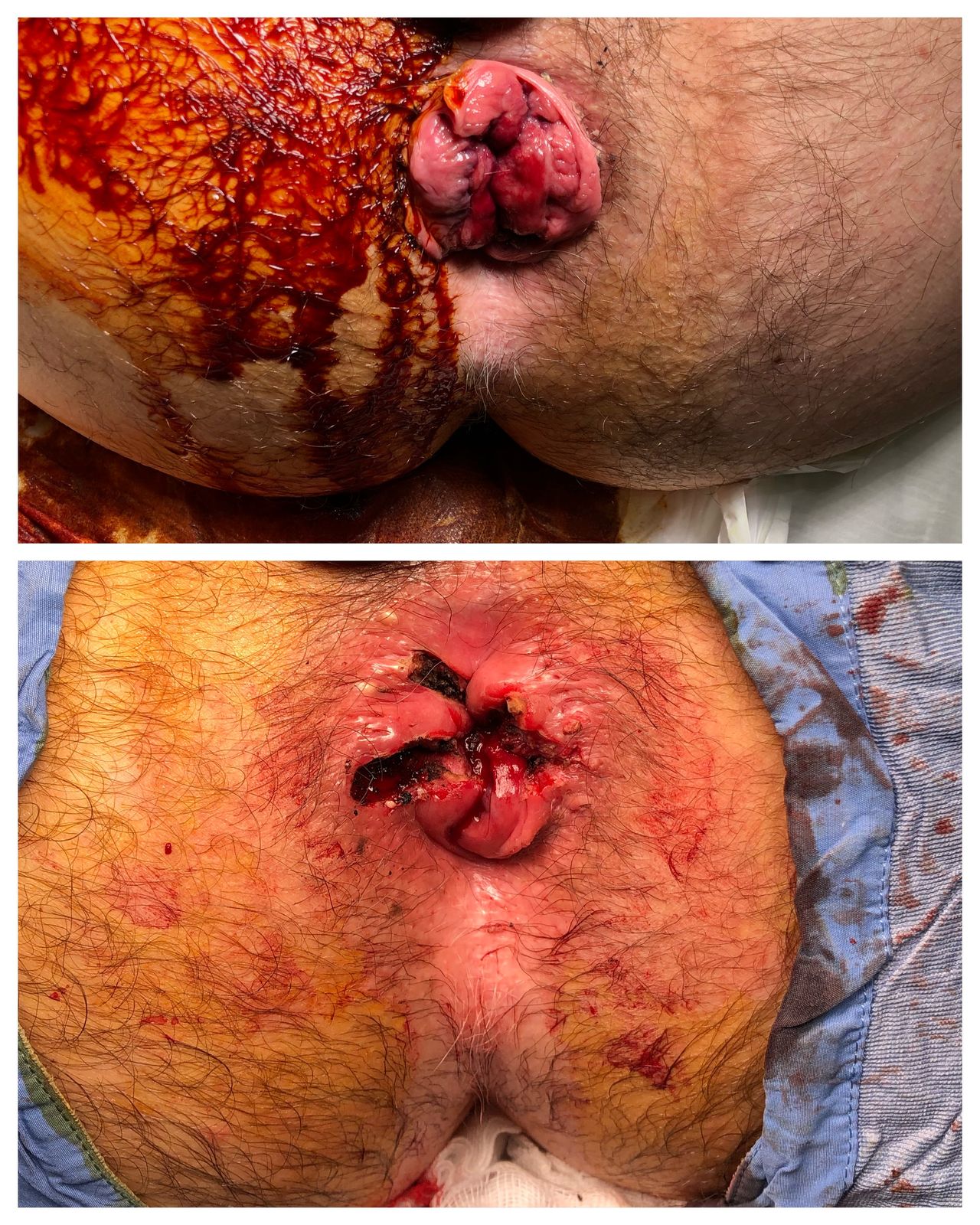 Antonio Ferronetti-7