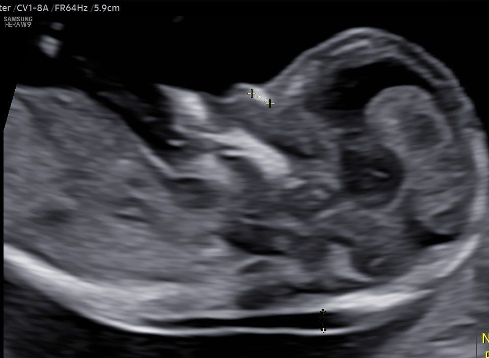 Valentina Conserva-6