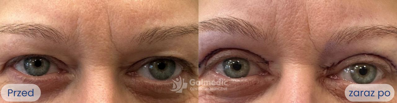 Jakub Staniszewski-9