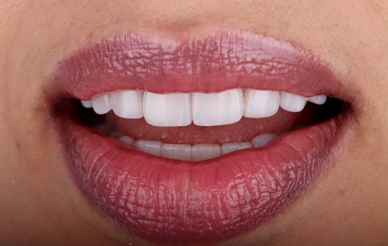 Pedro Antonio Fortuño Citoler-7