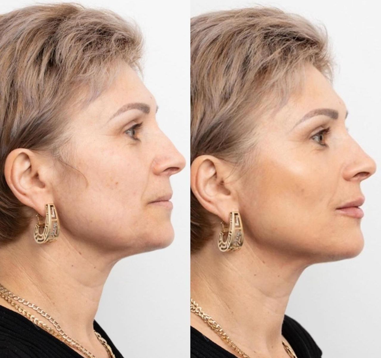 Raquel Moreno Pentinel-81