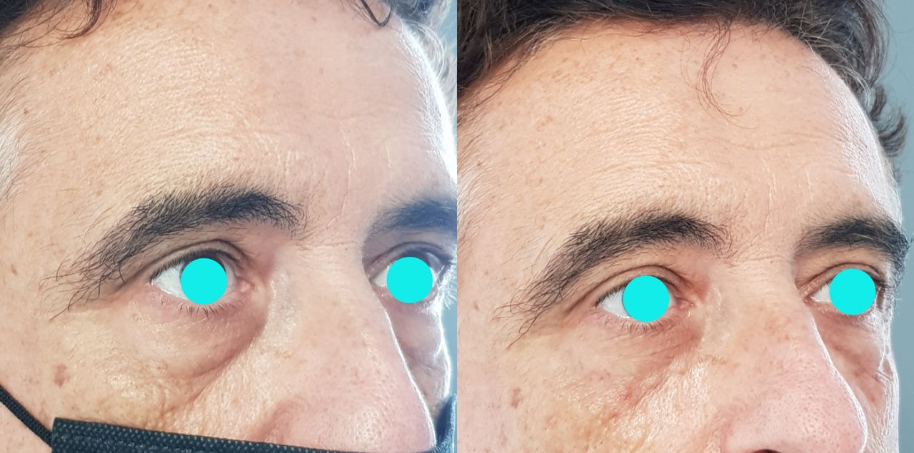 Rosalba Herrero Zerpa-123