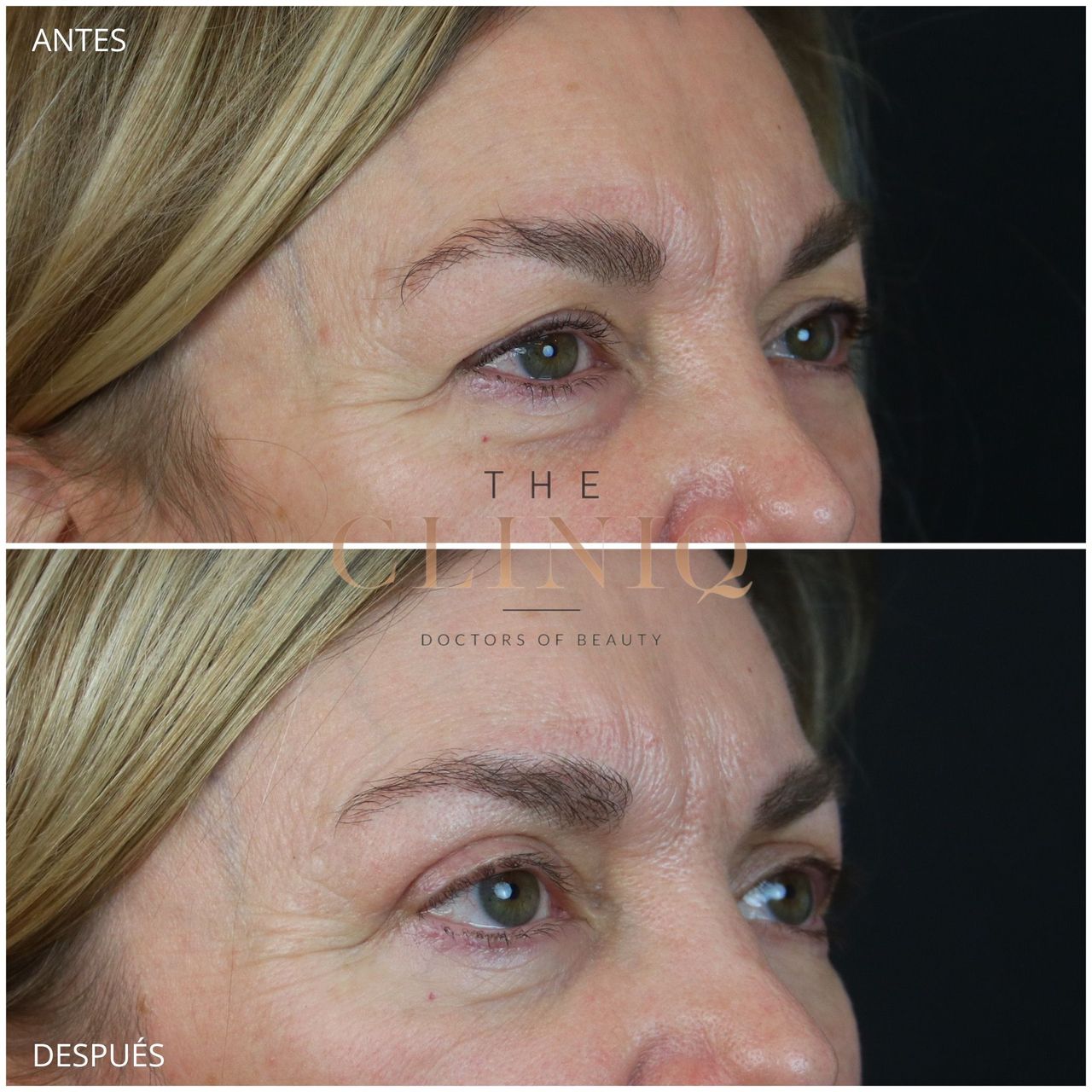 Ignacio Genol Saavedra-16