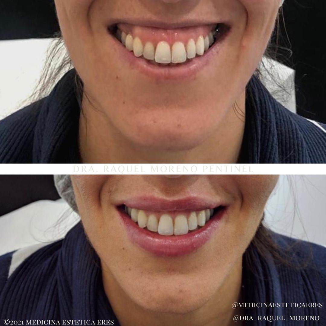 Raquel Moreno Pentinel-90