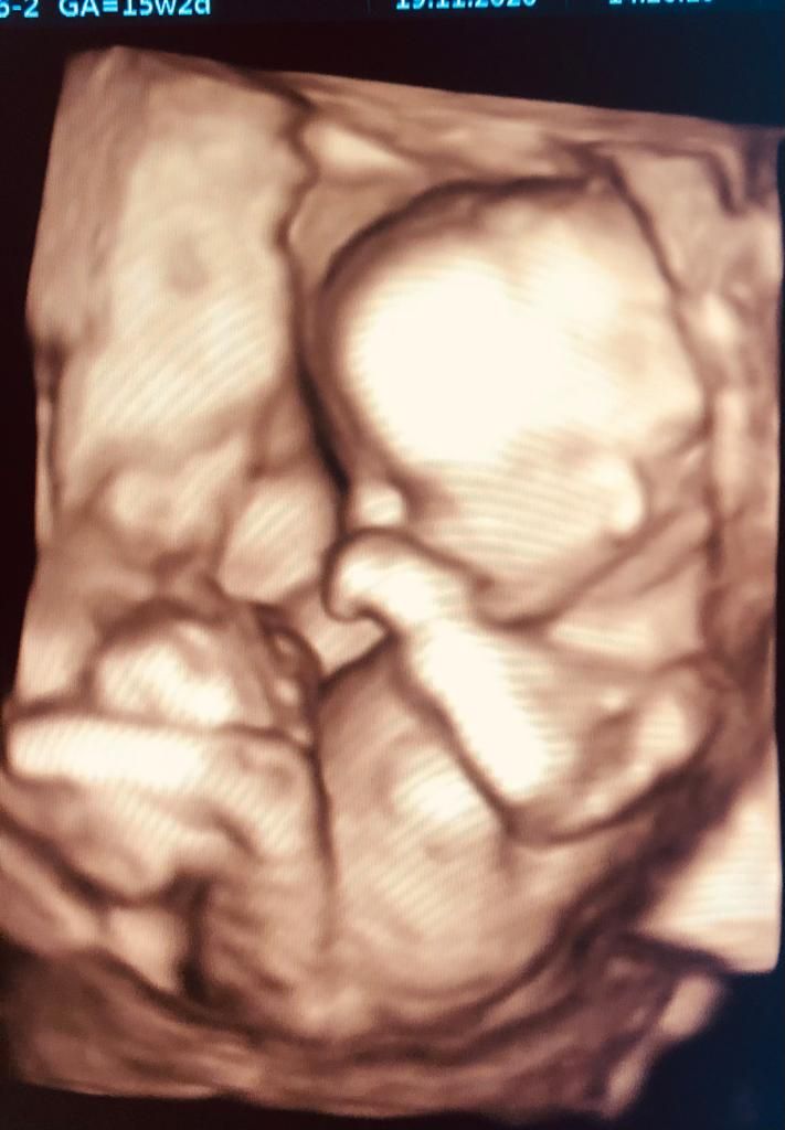 Dilek Turğut Kestane-20