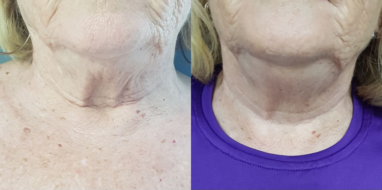 Rosalba Herrero Zerpa-465