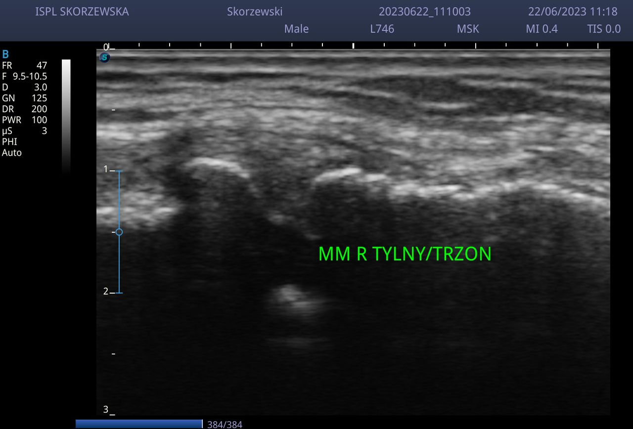 Agnieszka Skórzewska-1