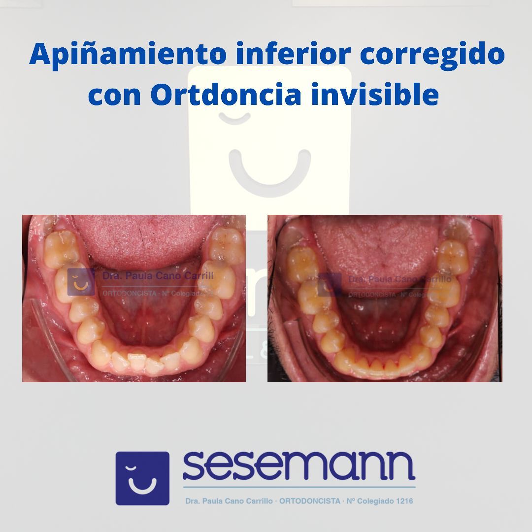 Paula Cano Carrillo-70