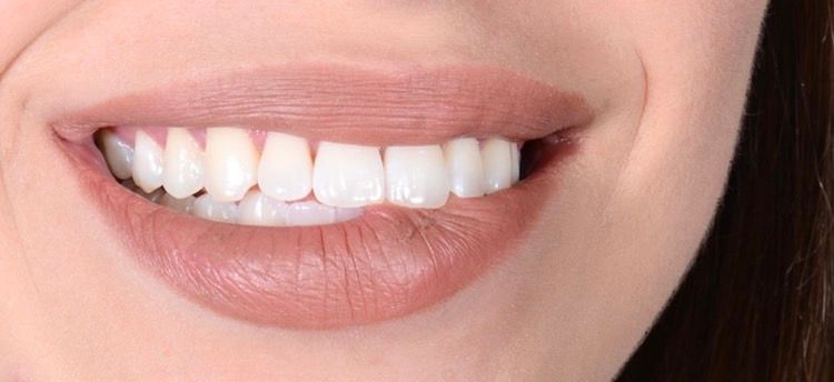 Giovanni Giordano-37