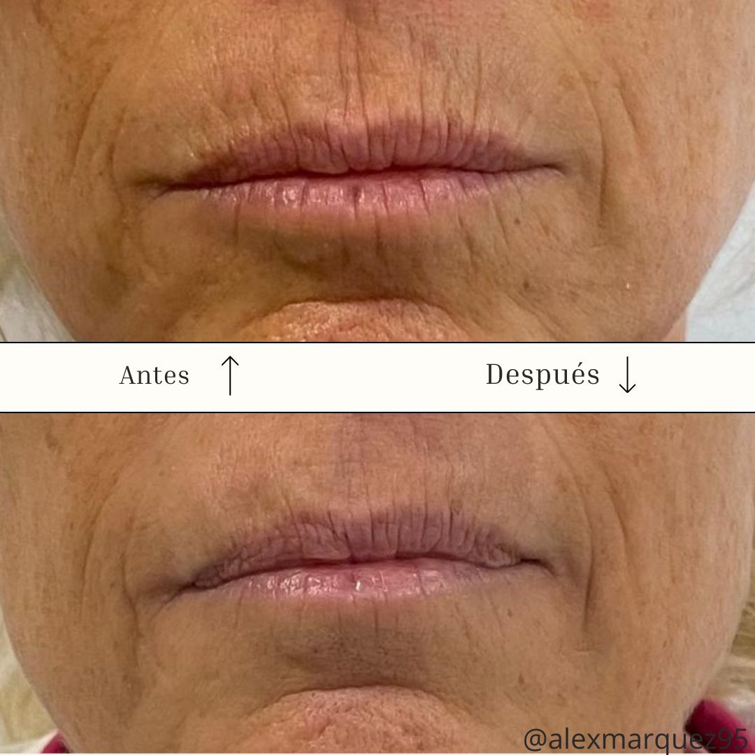 Alejandro Márquez Coloma-0