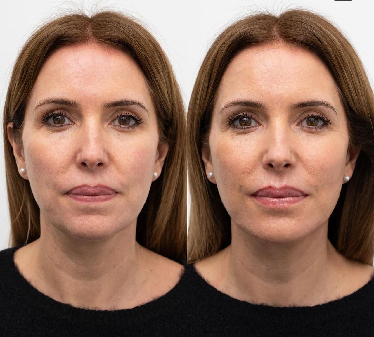 Raquel Moreno Pentinel-77