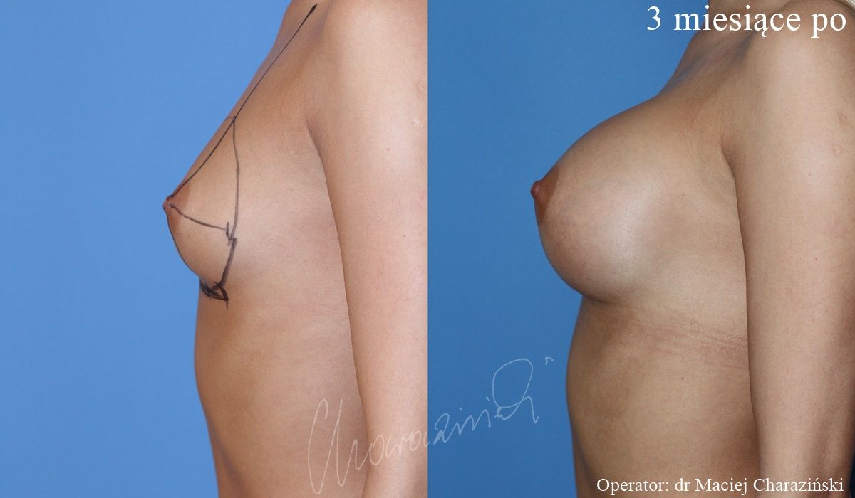 Maciej Charaziński-111