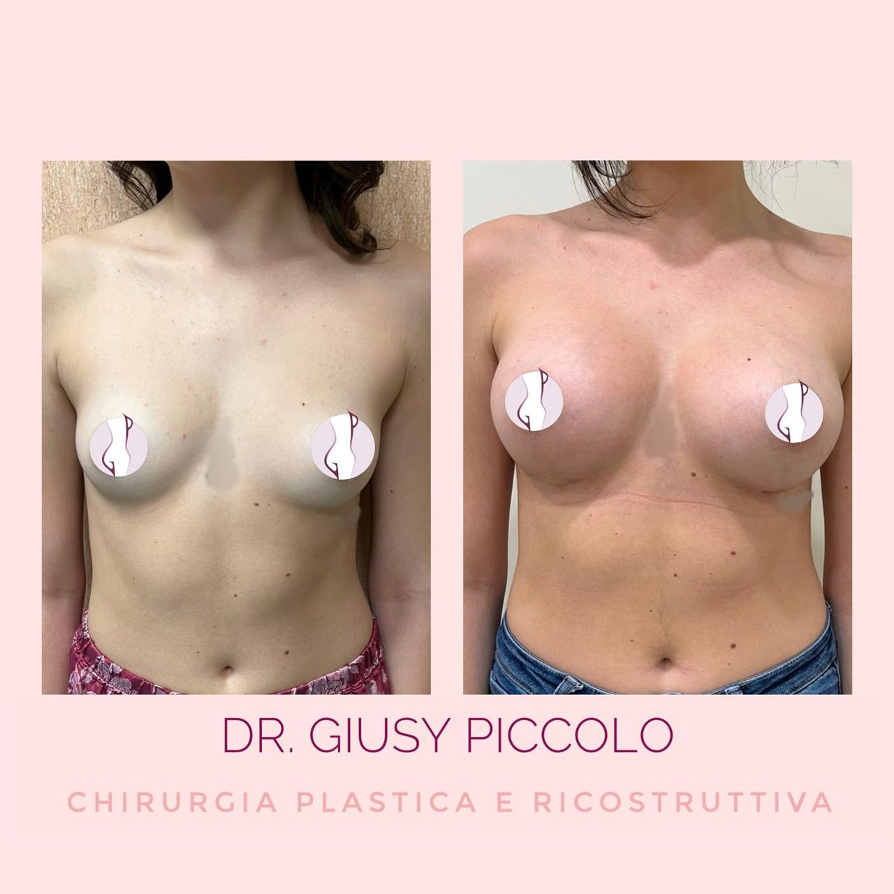 Giuseppina Piccolo-15