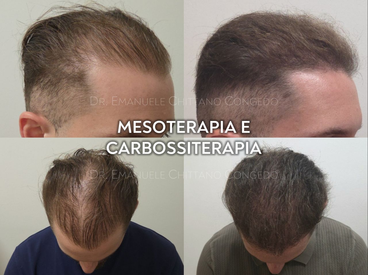 Emanuele Chittano Congedo-1