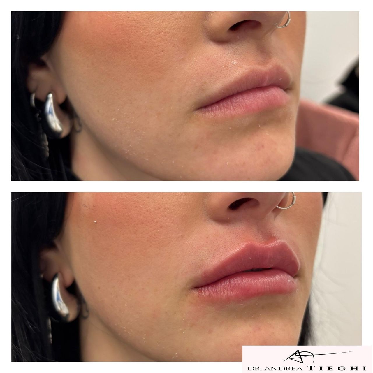 Andrea Tieghi-3