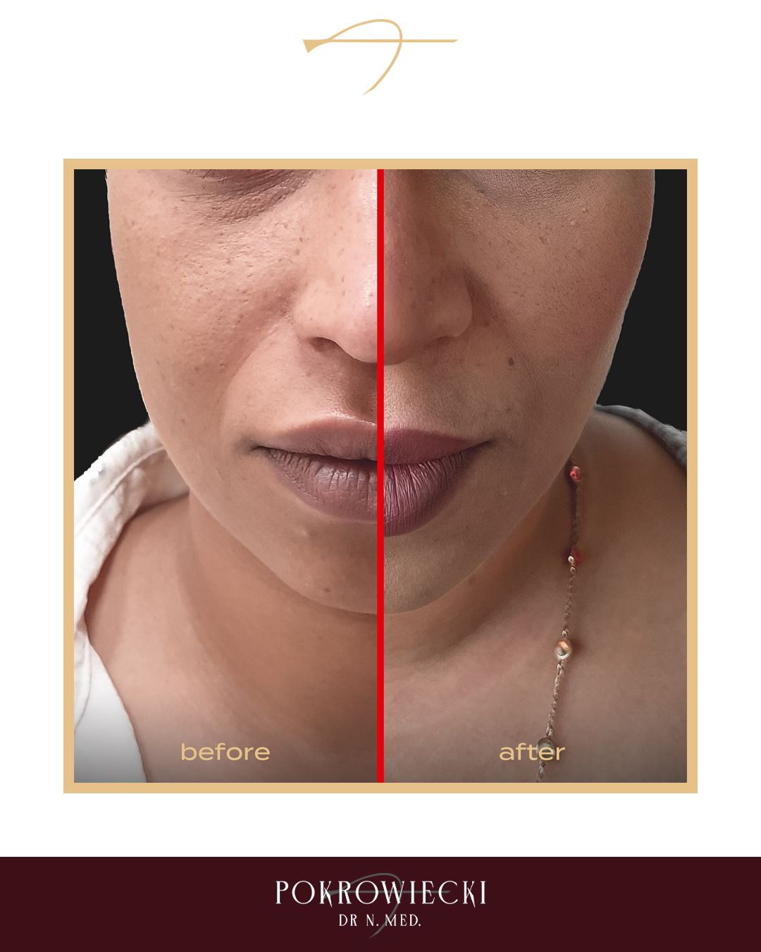 Rafał Pokrowiecki-38