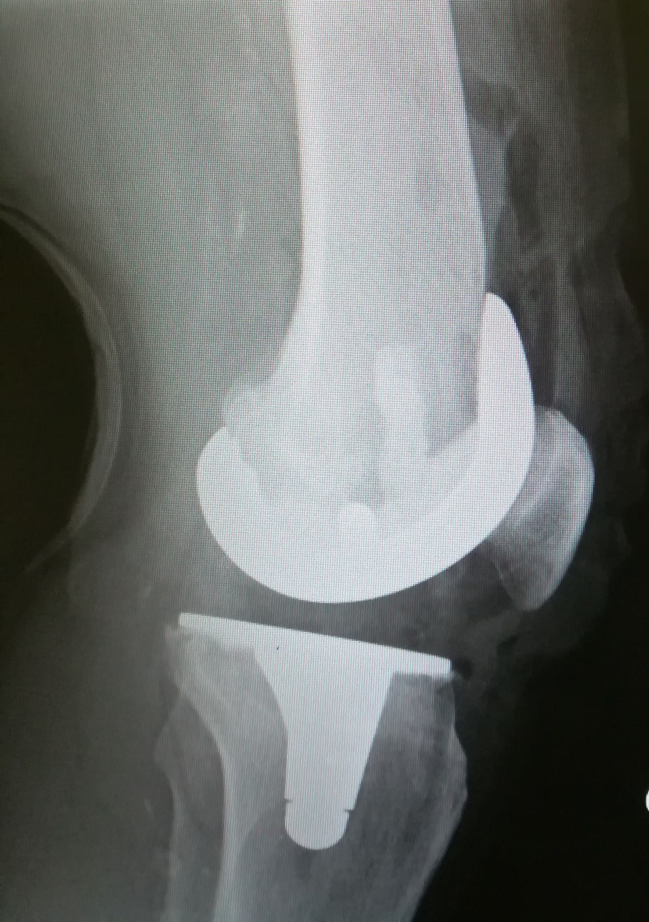 Gennaro Campopiano-2