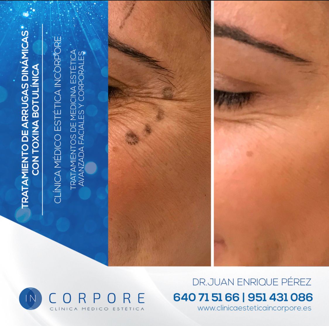 Juan Enrique Pérez Enríquez-107