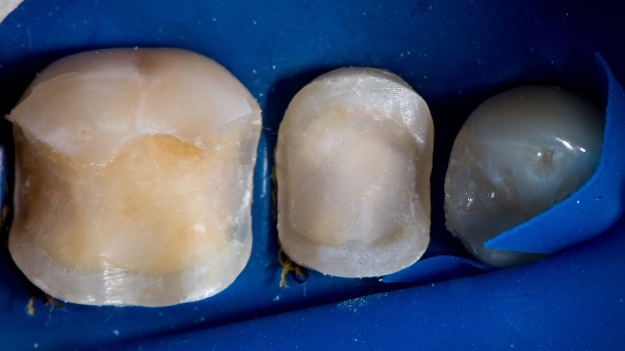 Volodymyr Kachmar-13