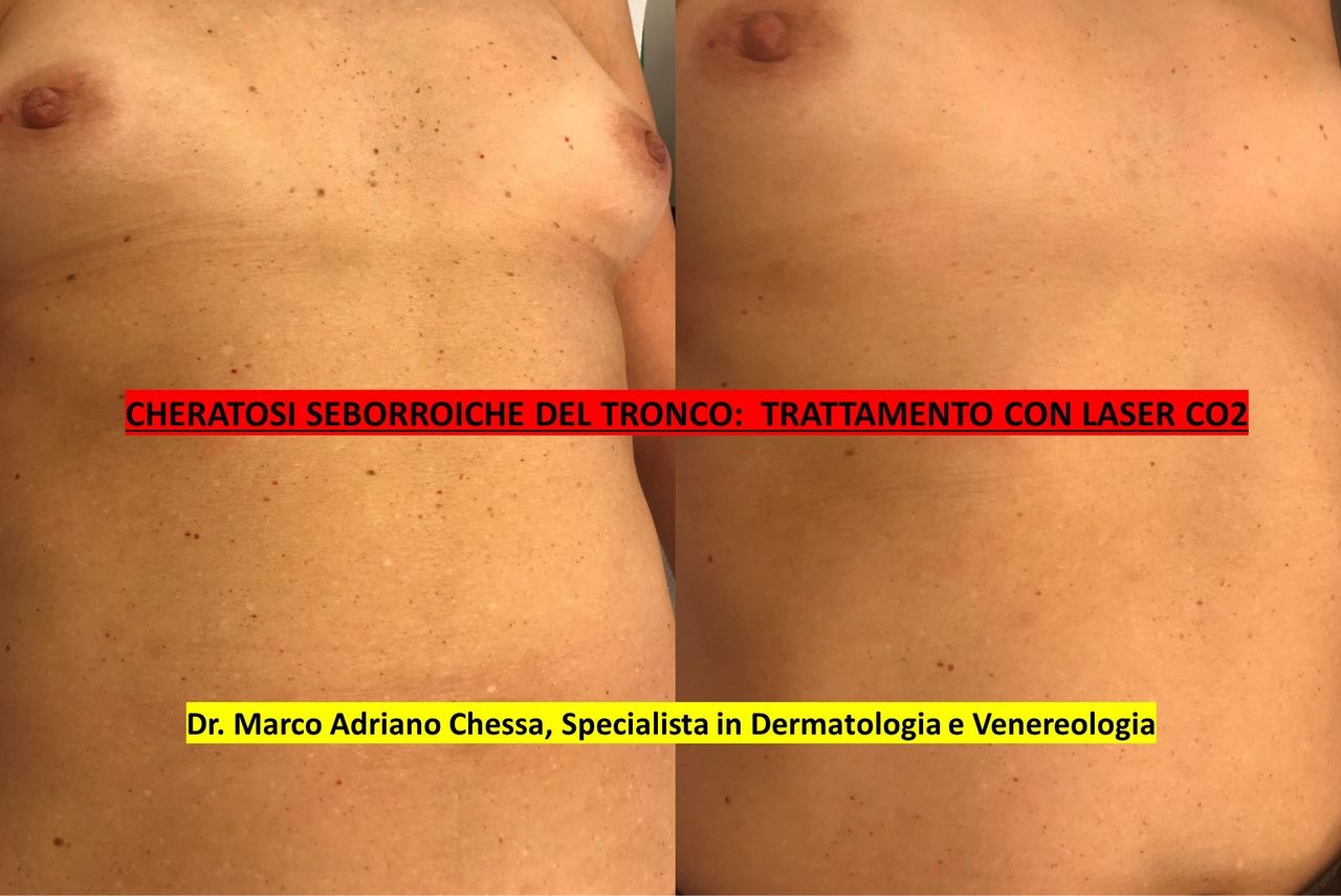 Marco Adriano Chessa-2