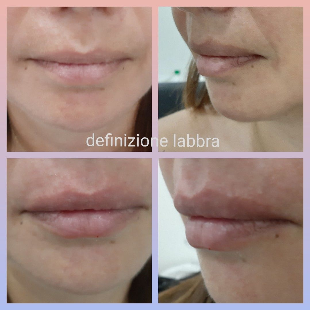 Paola Della Rocca-11