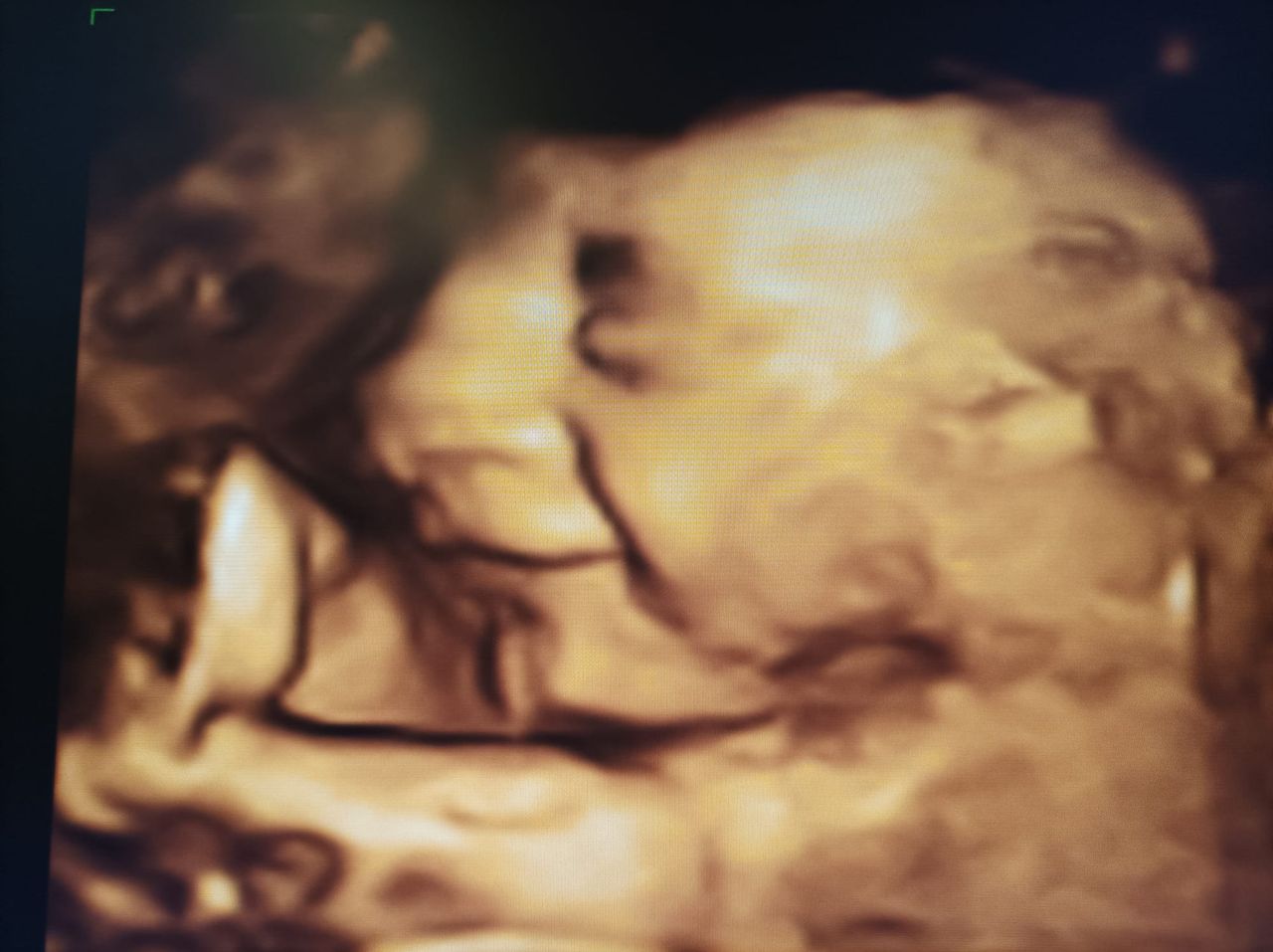 Medine Meltem Adalıoğlu-6