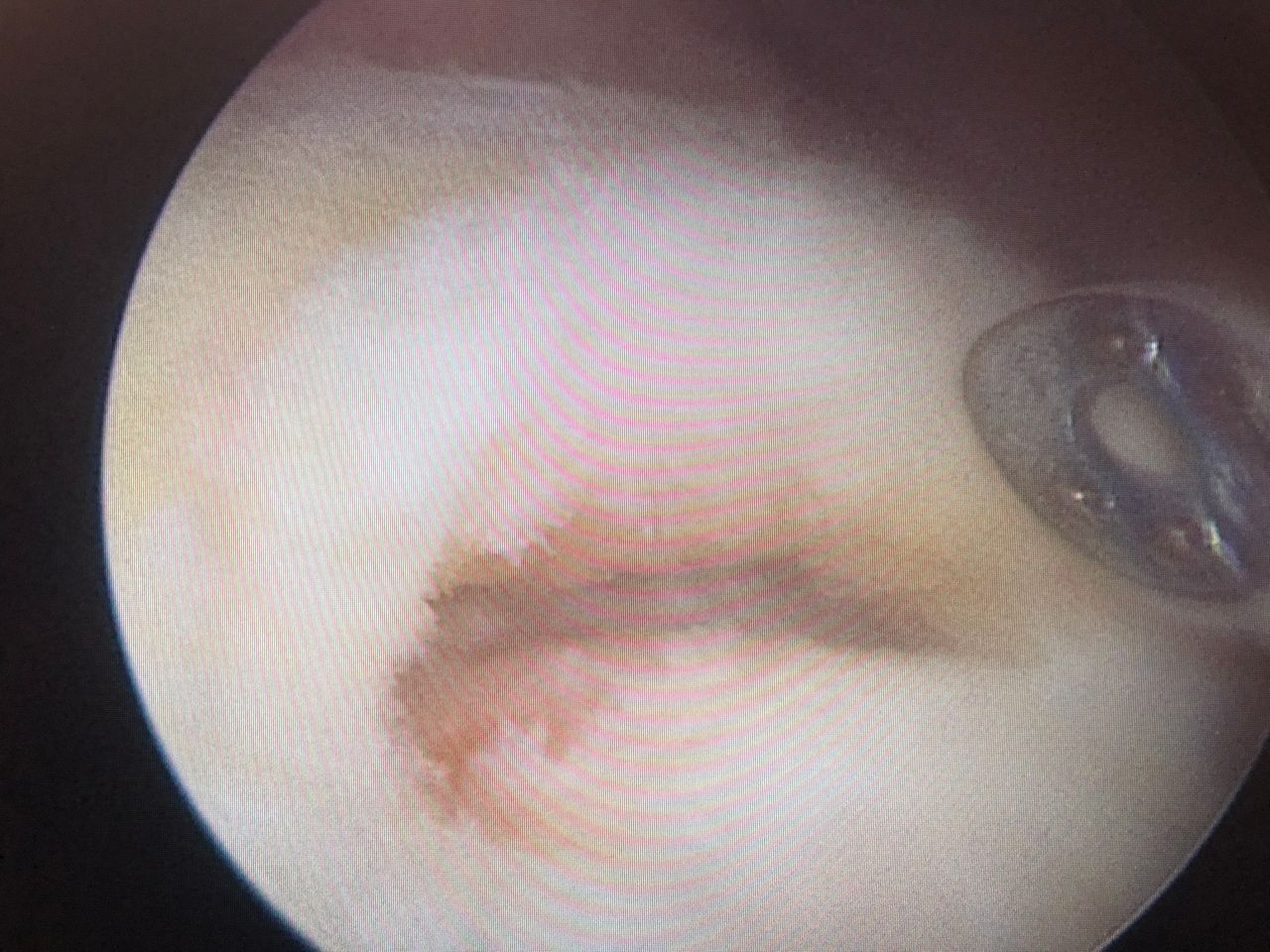 Jonathan Matellanes Higuera-0